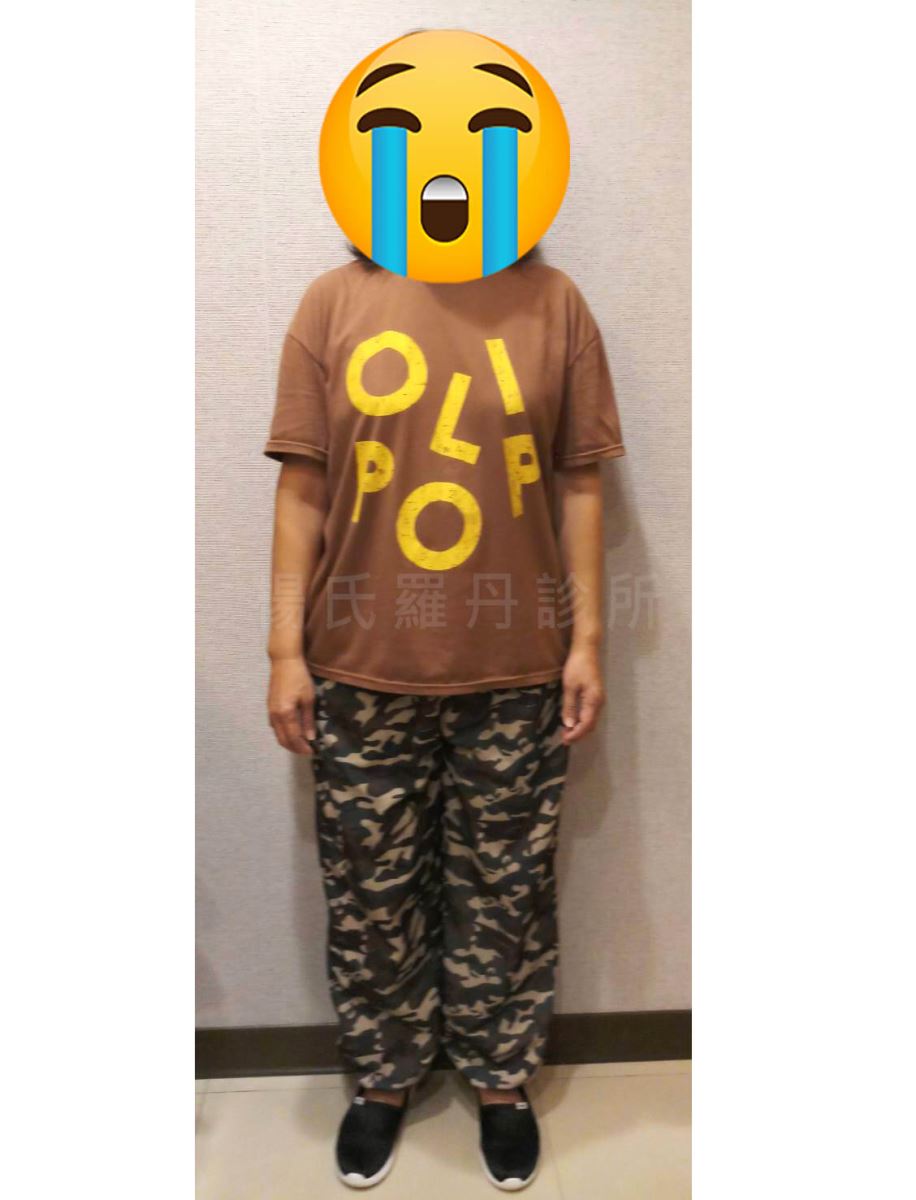 減肥 減重 肥胖  瘦身